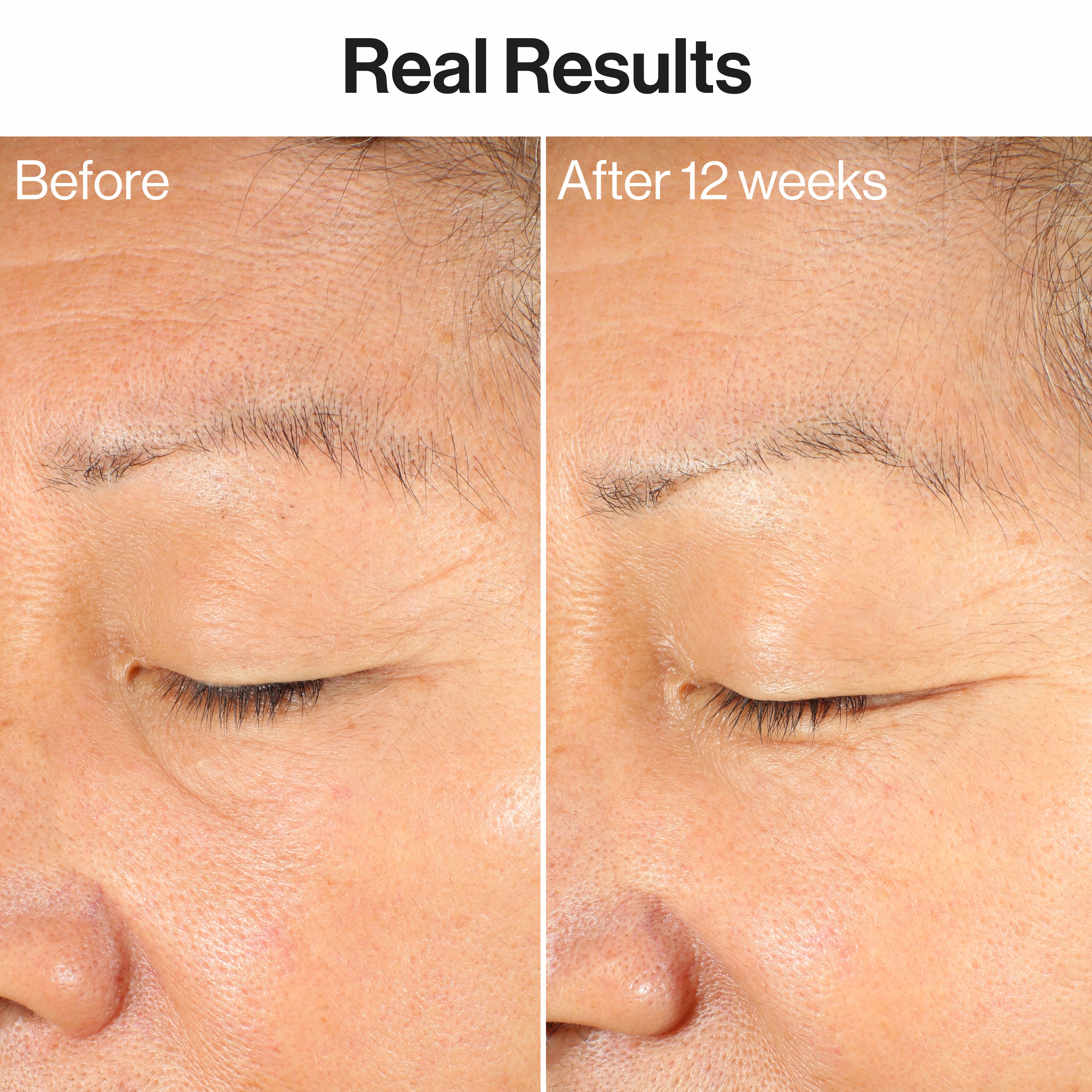 Ageless Firm + Even Serum - Image 3
